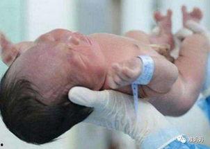 胎儿娩出过程视频